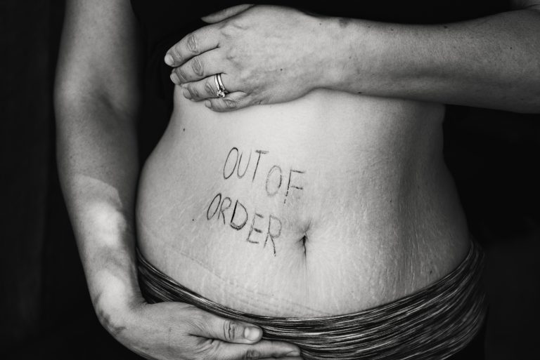 out-of-order-text-on-persons-belly-735966-768x513